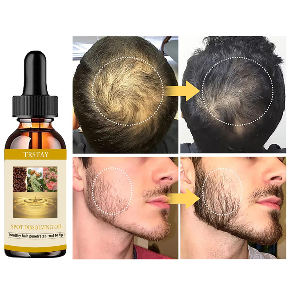 50ML sakal uzatma yağ Anti alo - Beard Oil incelemesi ve fiyatı